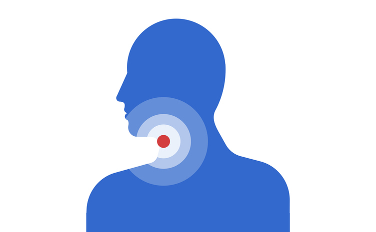 HRAS head and neck cancer
